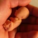 Federação Nacional dos Médicos e Juristas Católicos se posicionam contra aborto
